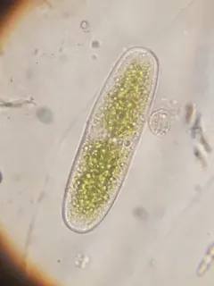 Netrium oblongum thumbnail 2