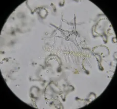 Ceratium hirundinella thumbnail 1