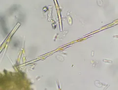 carpenter's rule diatom thumbnail 3