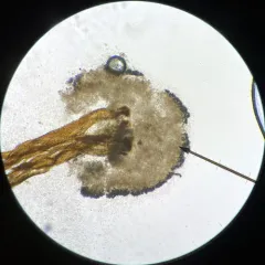 Chaenotheca gracilenta thumbnail 2