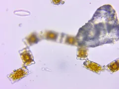 Odontella aurita thumbnail 2