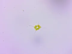 Dictyocha fibula thumbnail 2