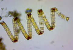 Chaetoceros debilis thumbnail 4