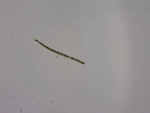 Dolichospermum planctonicum