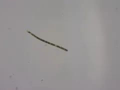 Dolichospermum planctonicum thumbnail 1