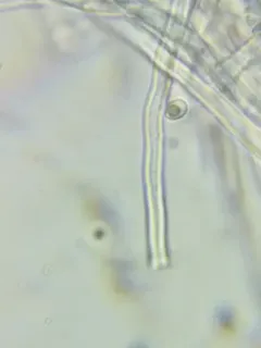 Stringy Butt Rot thumbnail 1