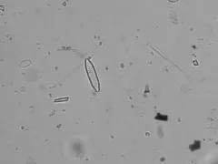 Fragilaria vaucheriae thumbnail 2
