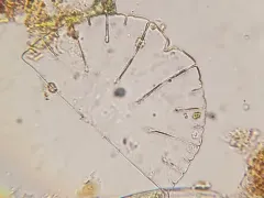 Micrasterias thomasiana thumbnail 2