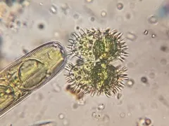 Staurastrum polytrichum thumbnail 2