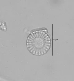 Stephanodiscus minutulus thumbnail 1