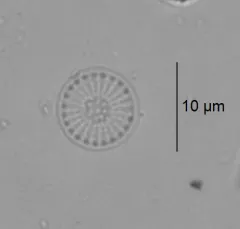 Stephanodiscus minutulus thumbnail 2