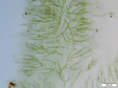 Chaetophora lobata thumbnail 4