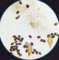 Panaeolus bisporus thumbnail 2