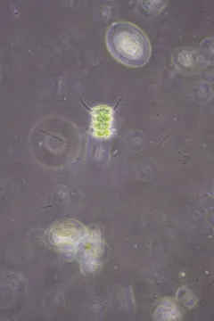 Desmodesmus opoliensis thumbnail 2