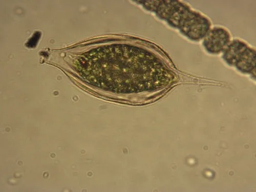 Strombomonas costata