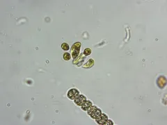Nephrocytium agardhianum thumbnail 4