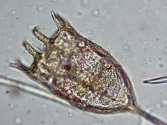 Keratella cochlearis thumbnail 2