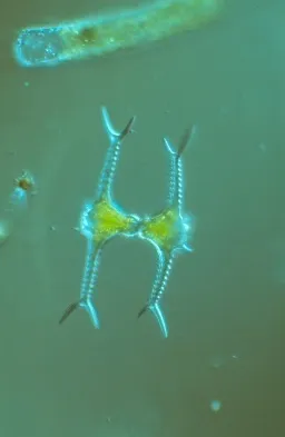 Staurastrum grallatorium