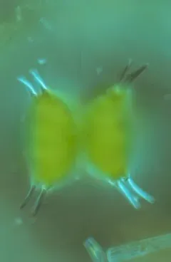 Staurastrum longispinum thumbnail 4