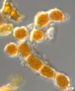 Trentepohlia umbrina thumbnail 3