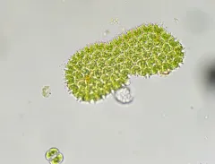 Pediastrum angulosum thumbnail 2