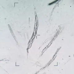 Lasiosphaeris hirsuta thumbnail 4