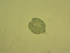 Phacus monilatus thumbnail 4