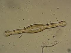 Pinnularia formica thumbnail 1
