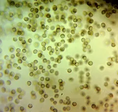 Reticularia jurana thumbnail 4