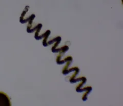Dolichospermum spiroides thumbnail 2