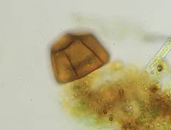 Arcella conica thumbnail 4