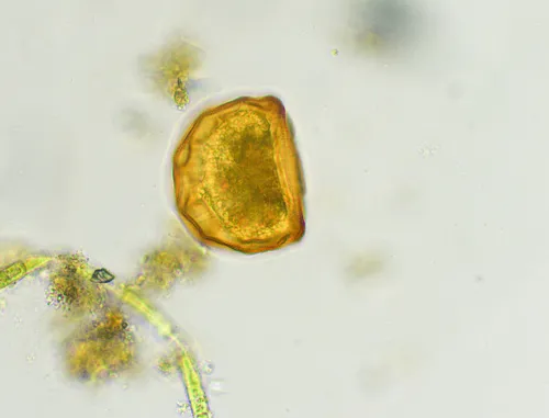Arcella gibbosa