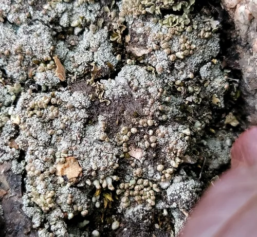 Nipple Lichen