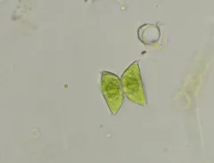 Staurastrum avicula thumbnail 3