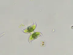 Staurodesmus dejectus thumbnail 3