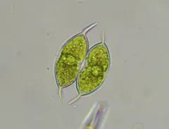 Staurodesmus convergens thumbnail 4