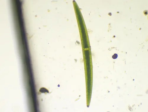 Closterium turgidum