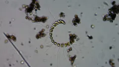 Chaetoceros curvisetus thumbnail 1