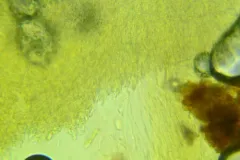 Neocudoniella radicella thumbnail 4