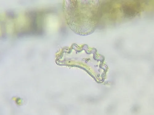 Eunotia diadema