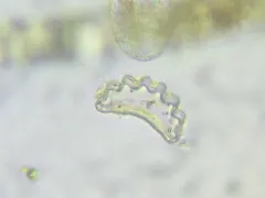 Eunotia diadema thumbnail 1