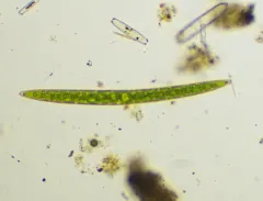 Closterium acerosum thumbnail 2
