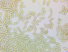 Lanmaoa pseudosensibilis thumbnail 2