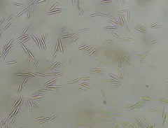 Monoraphidium tortile thumbnail 3