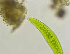 Closterium moniliferum thumbnail 3