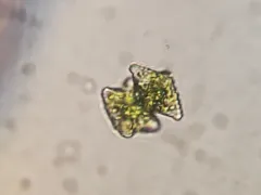 Staurastrum margaritaceum thumbnail 2