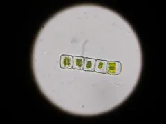 Hyalotheca mucosa thumbnail 3