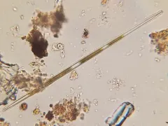 Ulnaria ulna thumbnail 3