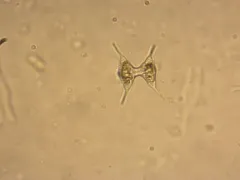 Staurodesmus cuspidatus thumbnail 3