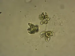 Kirchneriella lunaris thumbnail 1
